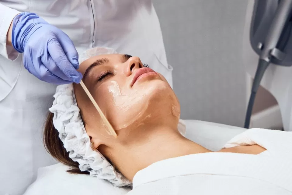 Photo of What Are the Benefits of PCA Peel Treatment? by healthcare
